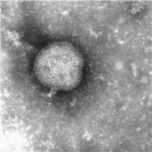 Bild på influensa A-virus.