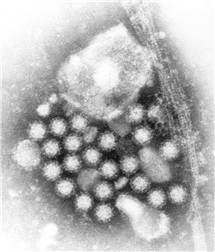 Norovirus (vinterkräksjuka). Foto: Kjell-Olof Hedlund