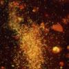 Mikroskopbild på Chlamydia trachomatis bakterier från livmoderhalsprov.