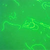 Mikroskopbild på Legionella pneumophila.