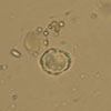 Mikroskopbild på Blastocystis hominis.