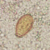 Mikroskopbild på Clonorchis/Opisthorchis, ägg.
