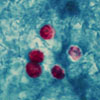 Mikroskopbild på Cryptosporidium oocystor