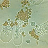 Mikroskopbild på Entamoeba histolytica trofozoiter med intracellulära och extracellulära rödablodkroppar.