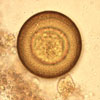 Mikroskopbild på Hymenolepis diminuta (råttbinnikemask), ägg.