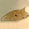 Mikroskopbild på Schistosoma mansoni, ägg.