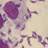 Mikroskopbild på Toxoplasma gondii tachyzoiter.