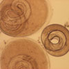 Mikroskopbild på Trichinella spiralis (trikin,) larver.
