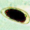 Mikroskopbild på Trichostrongylus, ägg.
