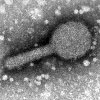 Mikroskopbild på fågelinfluensa, bilden visar ett lågpatogent virus (H5N2) preparerat från hönsägg.