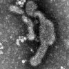 Mikroskopbild på fågelinfluensa, bilden visar ett lågpatogent virus (H5N2) preparerat från hönsägg.