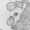 Mikroskopbild på hiv, avknoppade viruspartiklar (från humana lymfocyter).