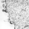 Mikroskopbild på hiv, knoppande viruspartiklar (från humana lymfocyter).