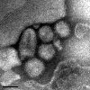 Mikroskopbild på den nya influensan A(H1N1) även kallad svininfluensa.
