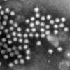Mikroskopbild på norovirus (vinterkräksjuka).