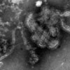 Mikroskopbild på paramyxovirus (mässling).