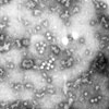 Mikroskopbild på picornavirus.